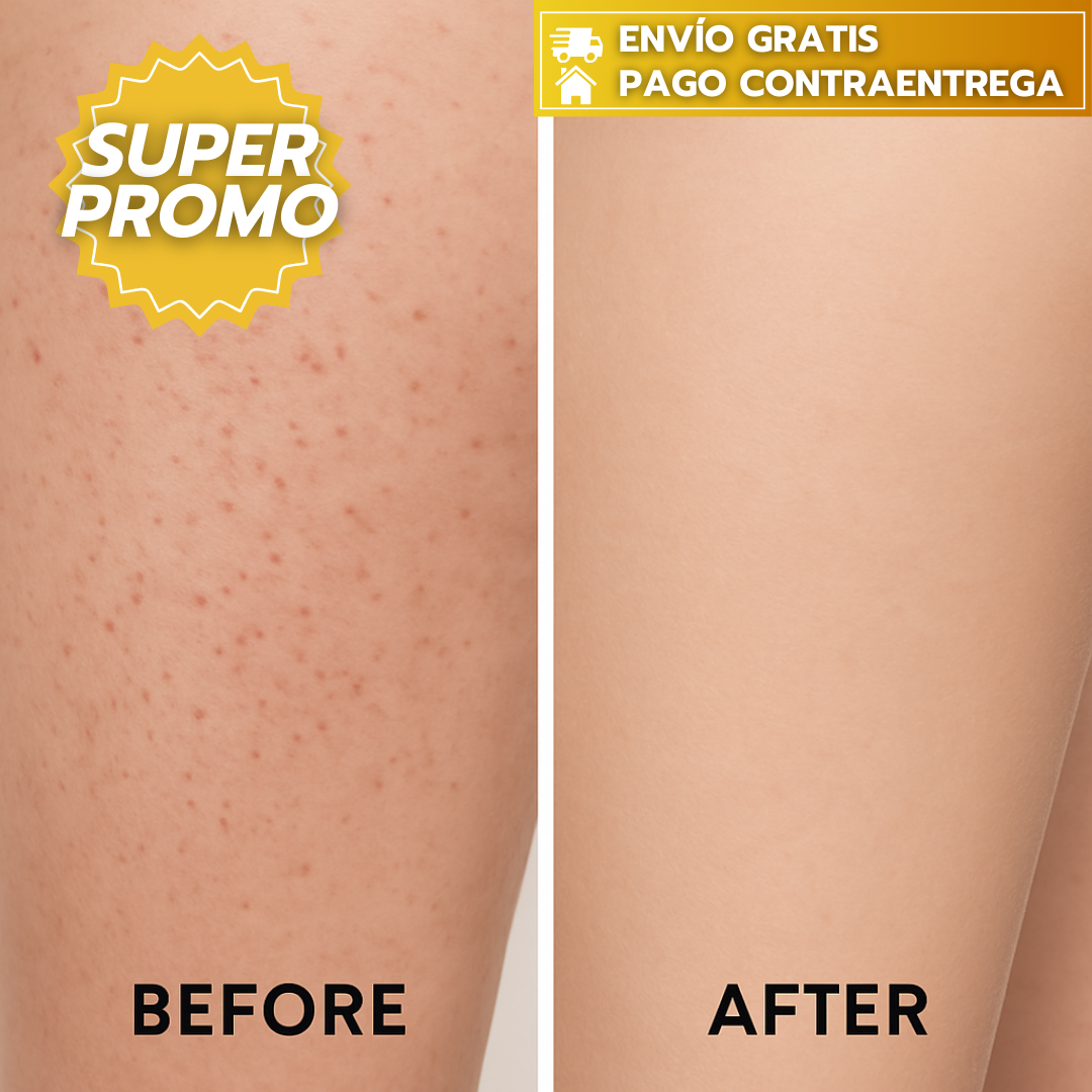 Peach Slices™: Solución post-afeitado que suaviza la piel, mejora la textura y previene la formación de vellos encarnados.